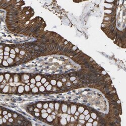 TMTC4 Antibody, Novus Biologicals:Antibodies:Primary Antibodies